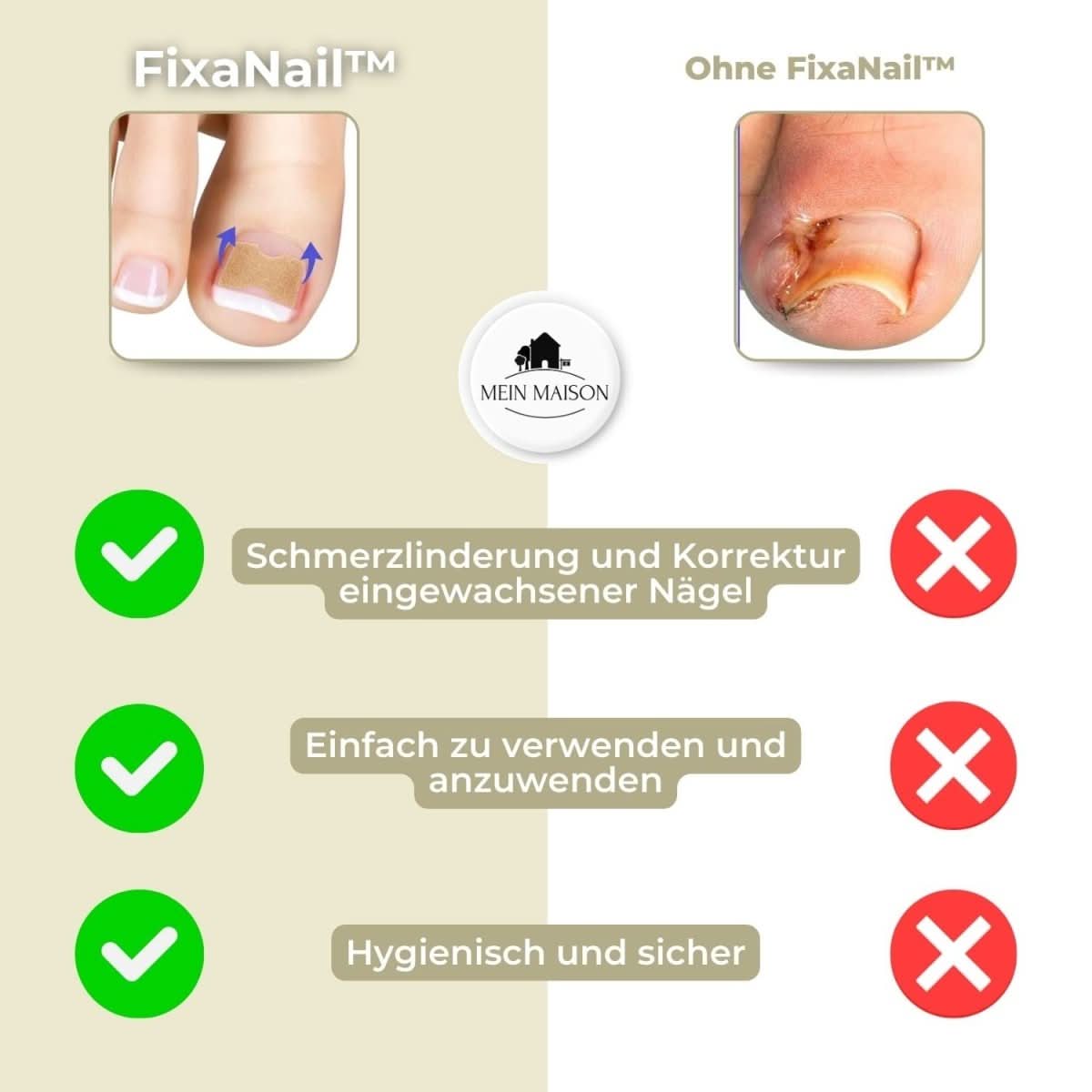ComfortFit Nail Relief System for Ingrown Nails