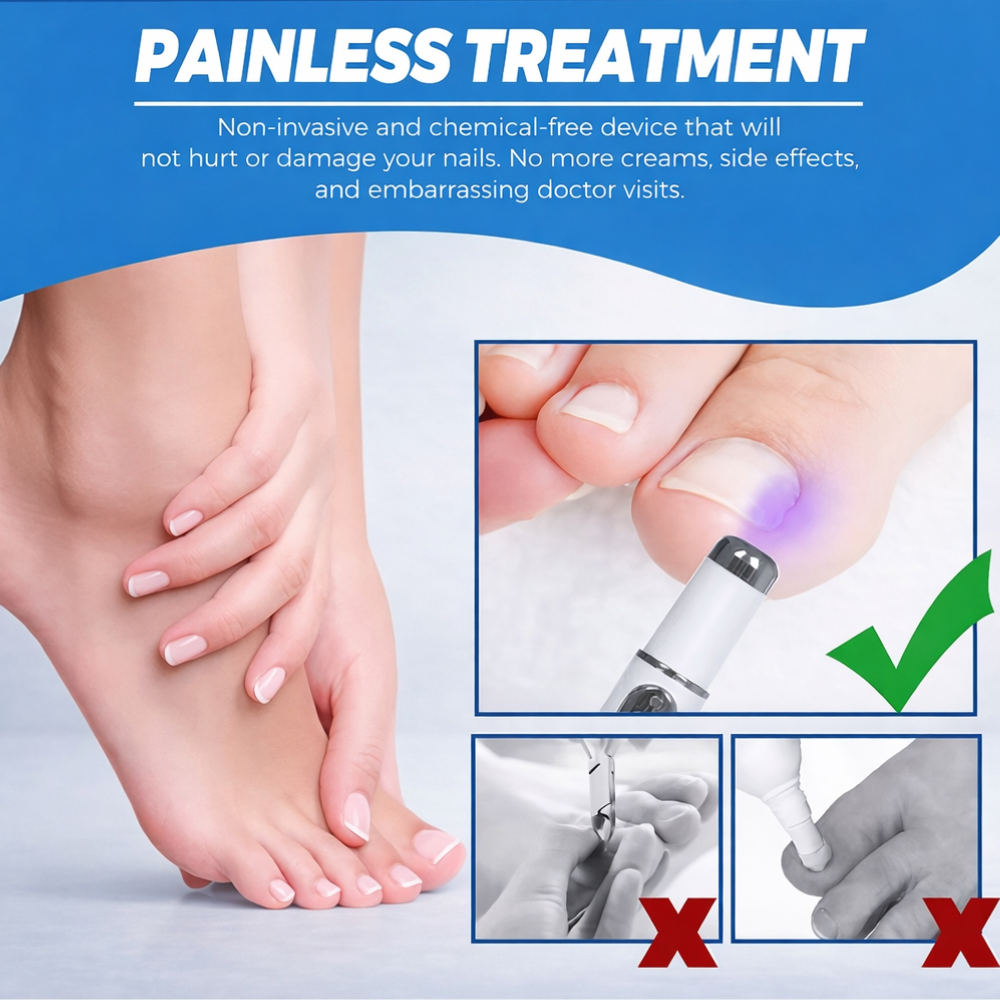 Non-Invasive Blue Light Laser Pen for Nail Fungus Treatment