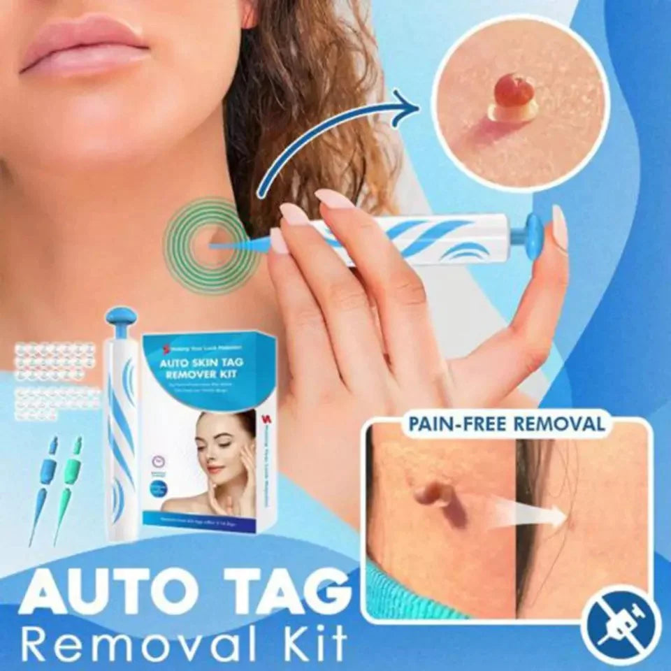 Skin Tag Removal Kit – Gentle Aero Tag Eliminator