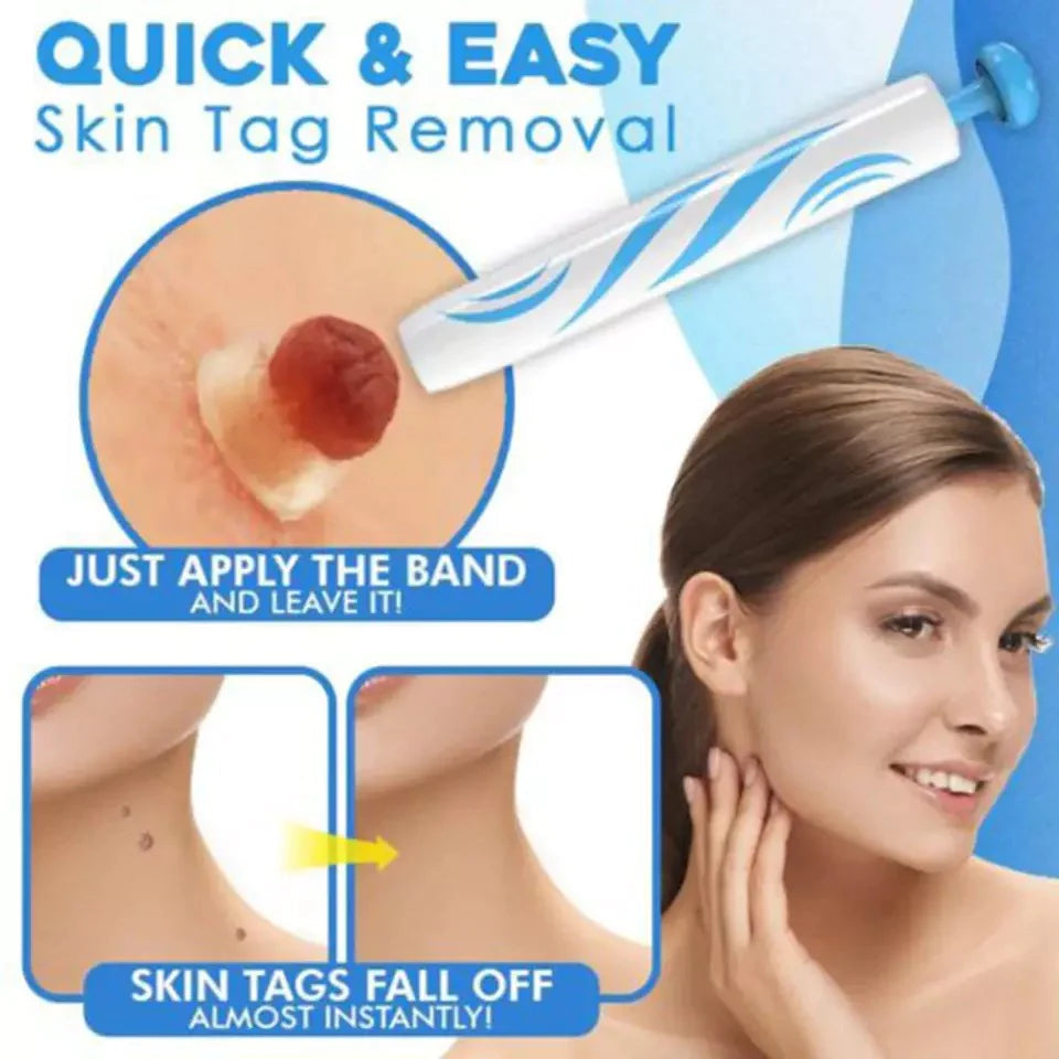 Skin Tag Removal Kit – Gentle Aero Tag Eliminator