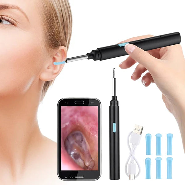 Smart Earwax Removal Tool with Visual Display