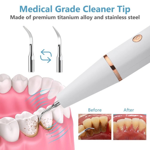 Home Tooth Cleaning Ultrasonic Wand with LED Light and USB Fast Charge