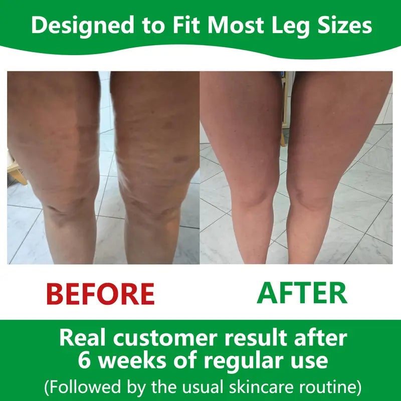 Deep-Tissue Massage Roller for Cellulite | 360° Adjustable Width Tool