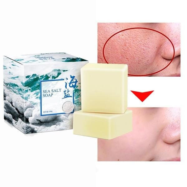 Acne Treatment Soap with Sea Salt