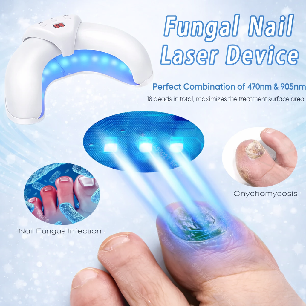Arc Lamp for Nail Treatment – Blue Light for Fungal and Lime Issues