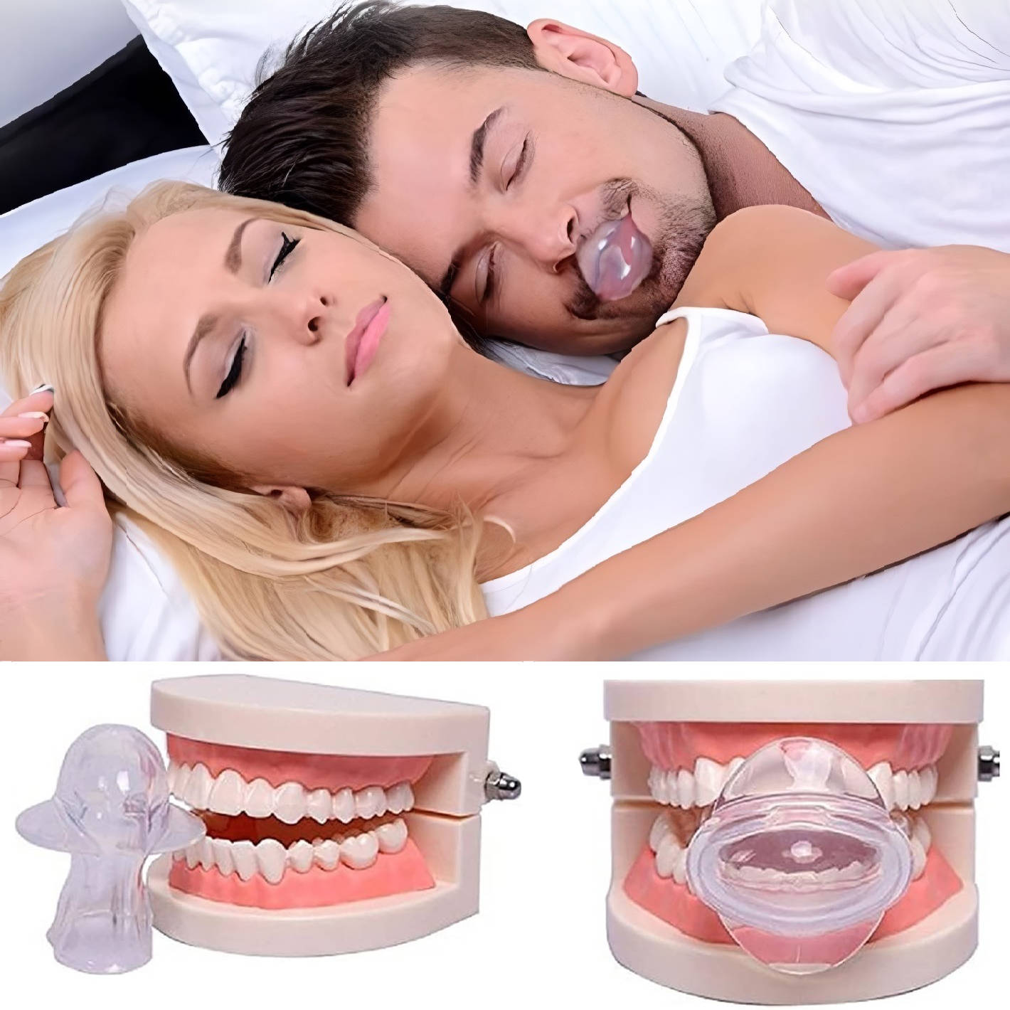 Non-Invasive Tongue Retainer for Snoring and Sleep Apnea Relief