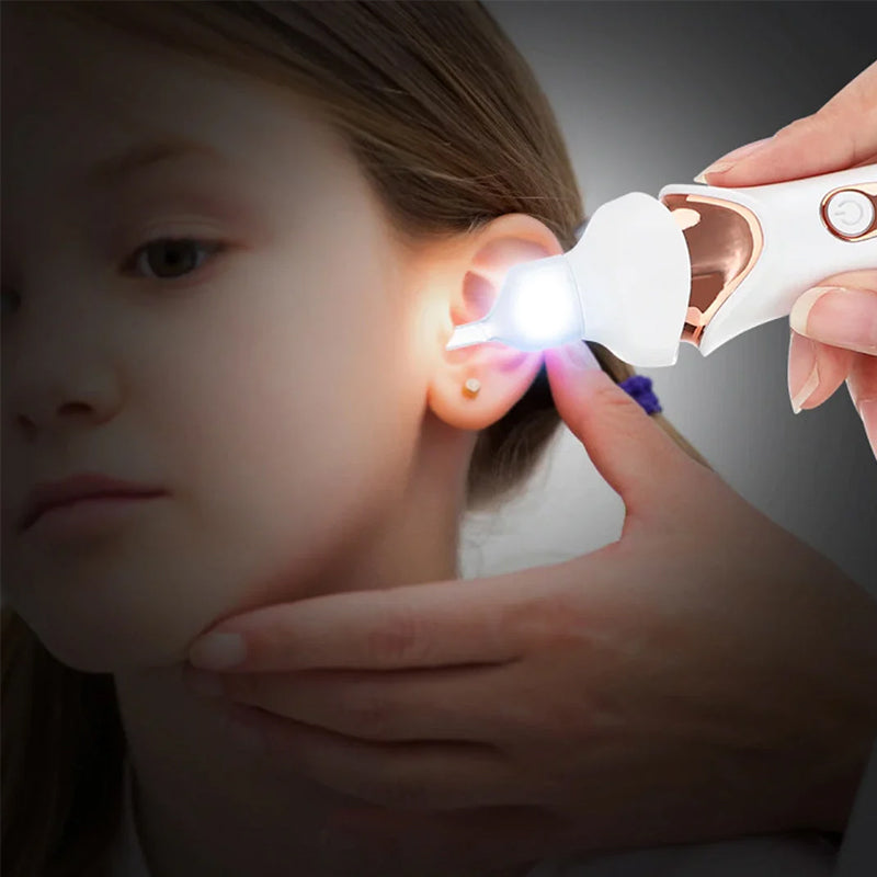 Electric Earwax Removal Tool – 5 Functions in One Device