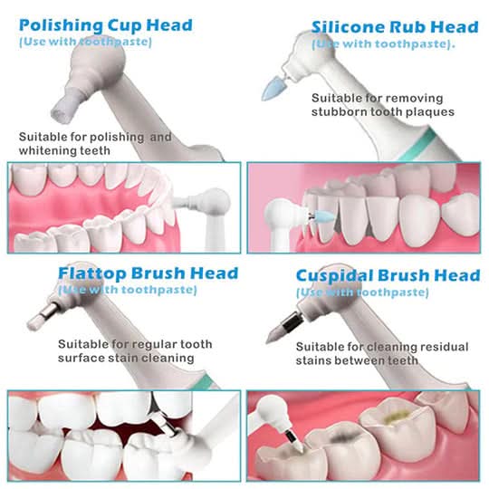 PureSmile Ultrasonic Dental Cleaner for a Bright, Healthy Smile