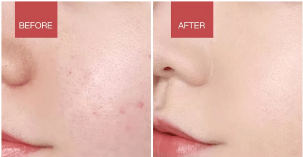 SonicGlow LED-Enhanced Silicone Facial Cleanser