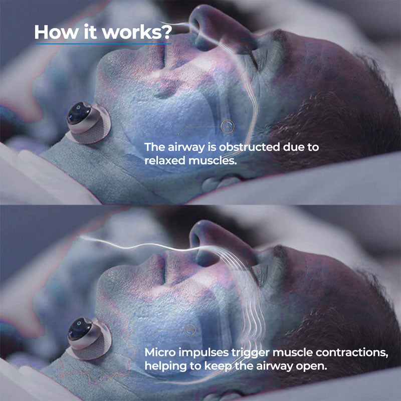 Wearable Chin Clip for Snore Detection | Comfortable Sleep Aid Device