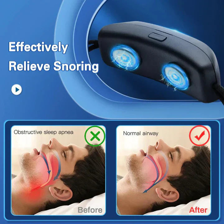 Rechargeable Anti-Snoring Device with Smart Features