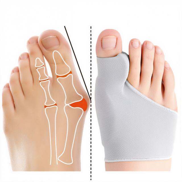 Bunion Sleeve | Gel Cushioning & Alignment Support | Low-Profile | Comfortable Fit