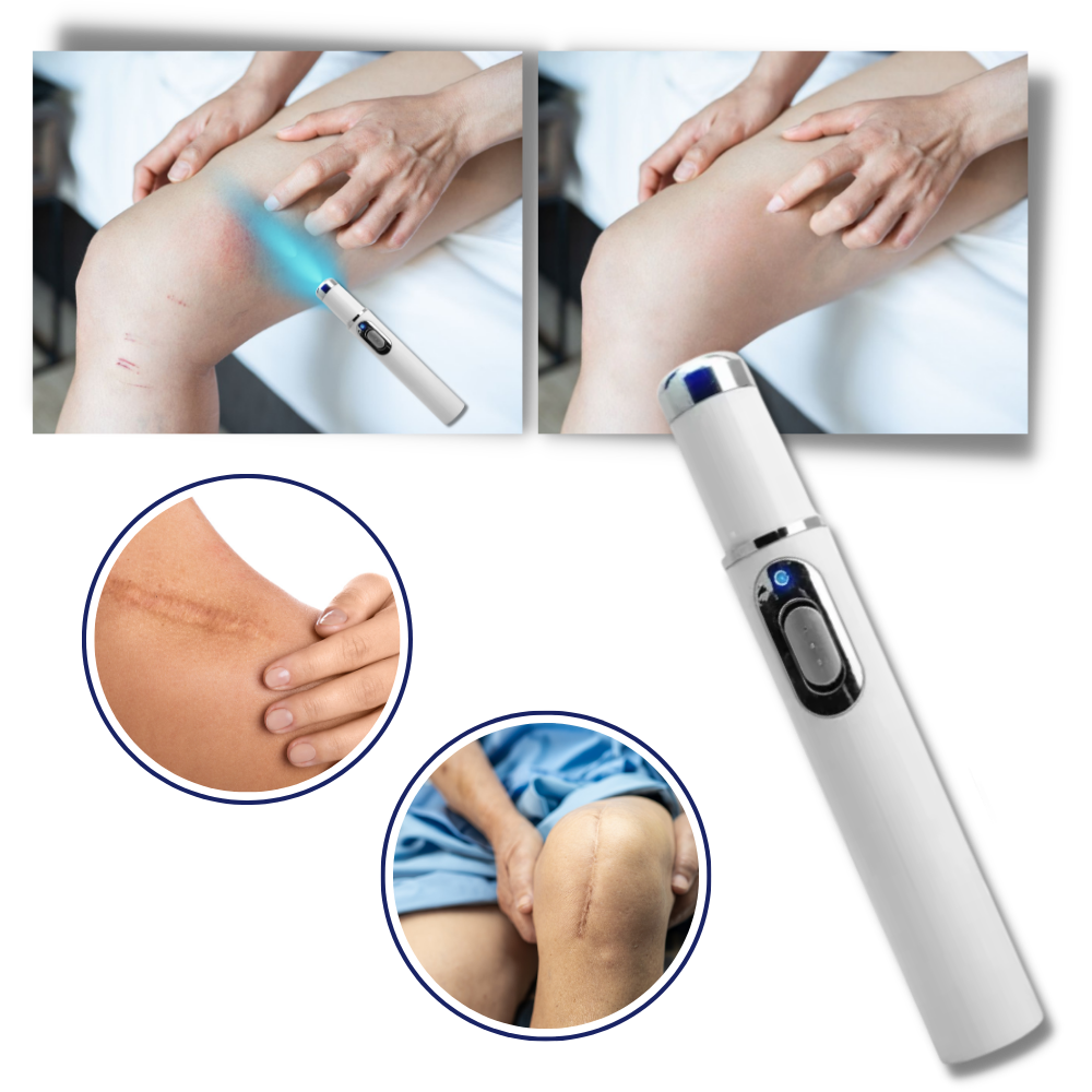 Portable Blue Light Skin Pen | Targeted Scar & Hyperpigmentation Treatment | Battery-Operated Travel Size
