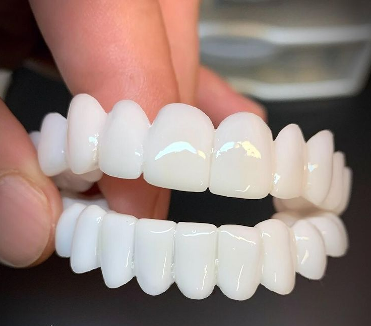 Removable Dental Veneers | Natural-Look Flexible Fit | Reusable & Comfortable