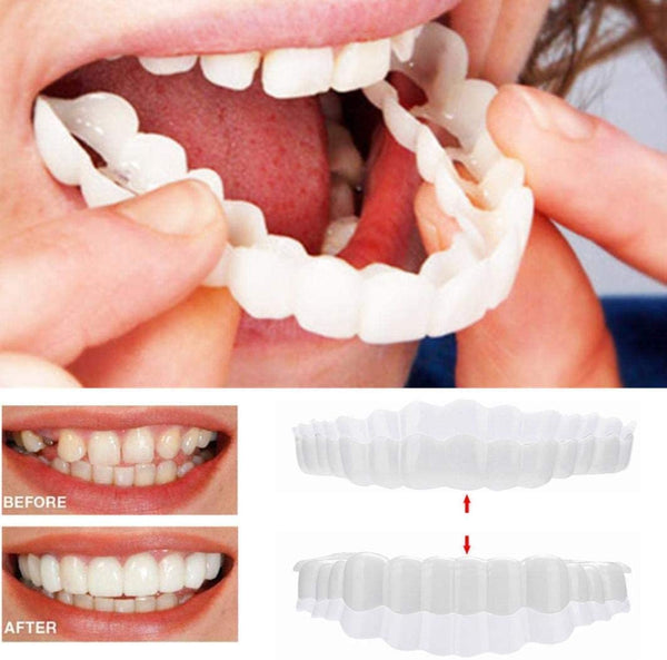 Removable Veneer Set (Upper & Lower) | Thin Natural-Looking | Acrylic Resin & Case | Comfort Fit