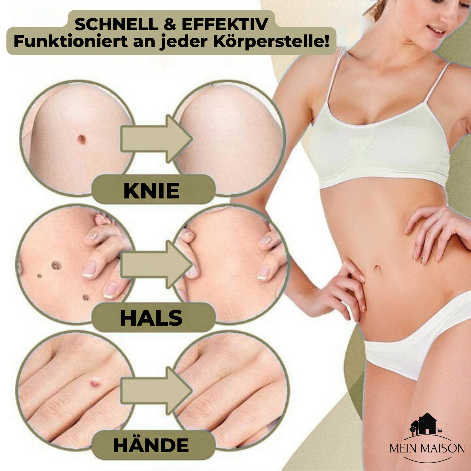 Wart & Mole Remover | Painless Non-Surgical Treatment | Skin-Friendly Formula | At-Home Use