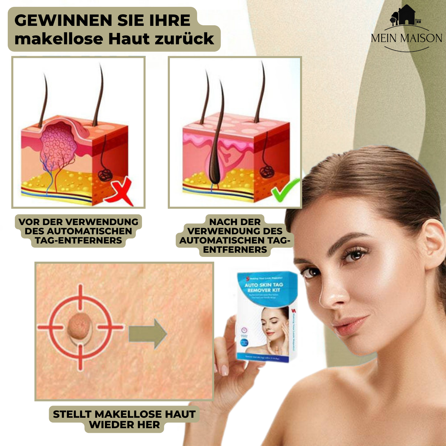 Wart & Mole Remover | Painless Non-Surgical Treatment | Skin-Friendly Formula | At-Home Use