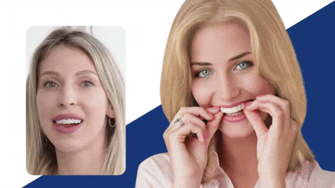 SmileBright Instant Tooth Transformation Kit