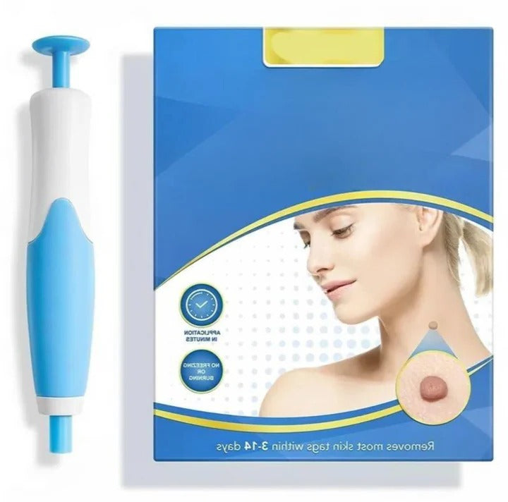 At-Home Skin Tag Removal System with Silicone Bands & Tool