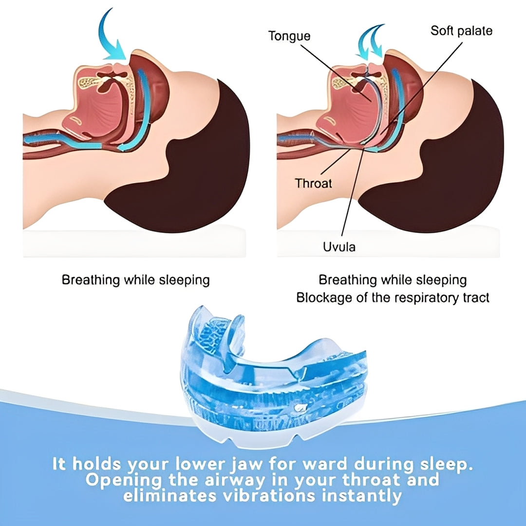 Custom-Fit Sleep Mouthpiece with Adjustable Screw Mechanism