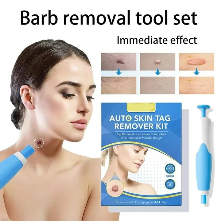 Advanced Skin Tag Removal Kit with Precision Applicator