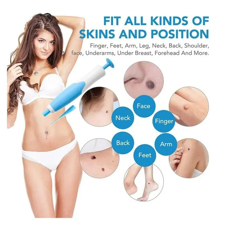 Advanced Skin Tag Removal Kit with Precision Applicator