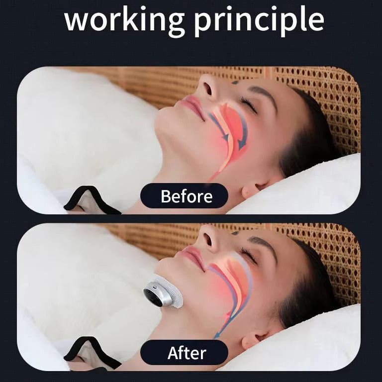 Revolutionary Sleep Relief Device with Smart Adjustments
