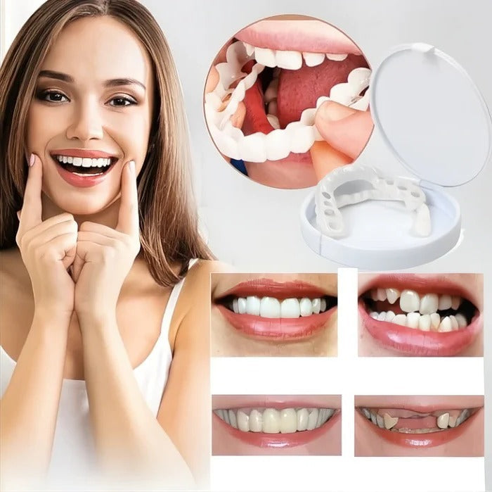 Natural White Finish Teeth Veneers