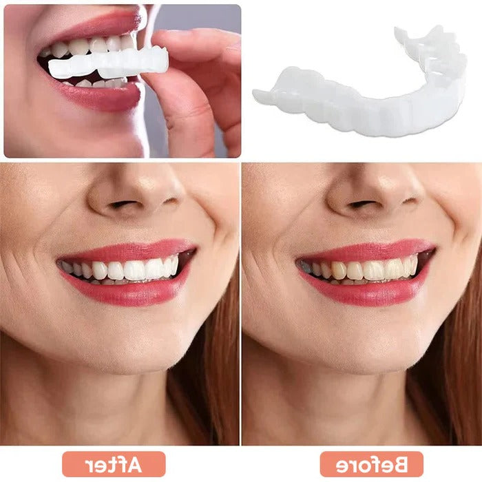 Natural White Finish Tooth Veneers