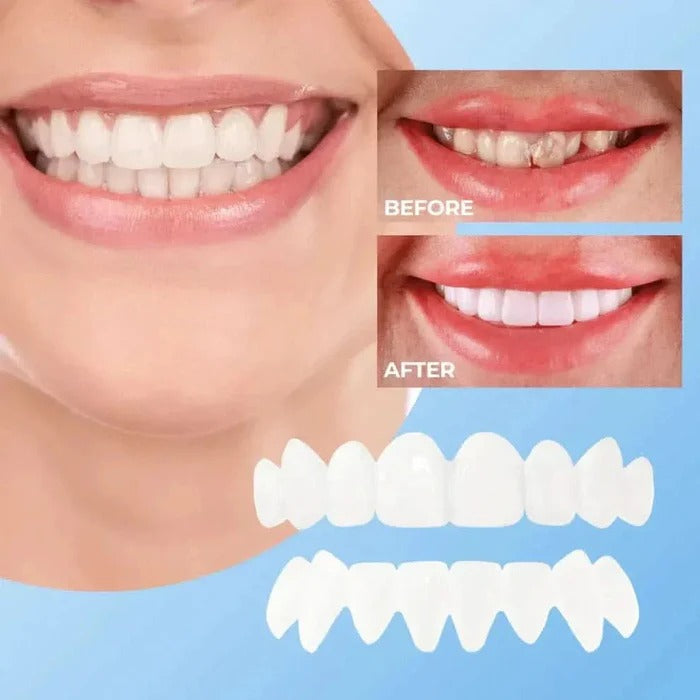 Natural White Finish Tooth Veneers