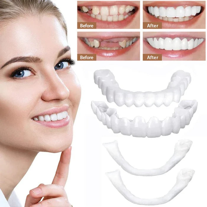 Natural White Finish Tooth Veneers