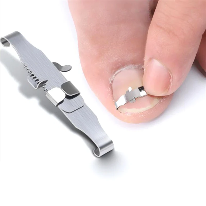 Foot Care Tool for Ingrown Toenail Correction and Health Treatment