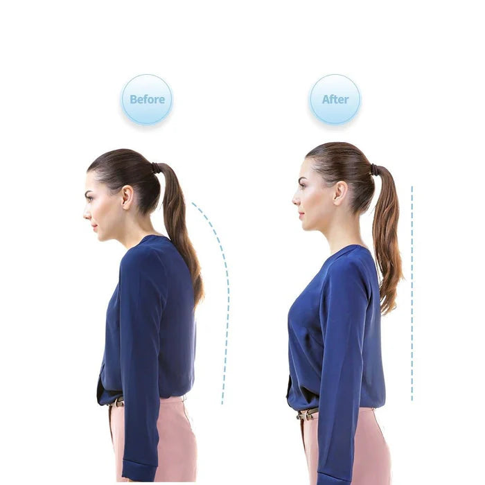 Posture Support Device - Neck Hump Straightener for Adults and Children