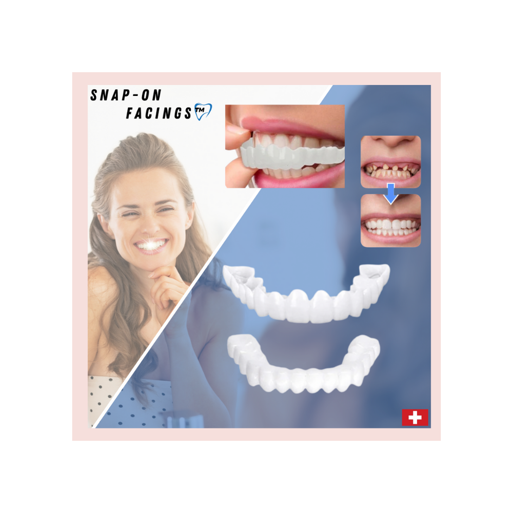 SmileBright Instant Tooth Transformation Kit