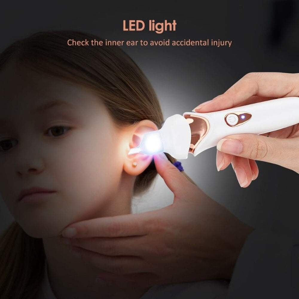 GentleEar Pro Vacuum for Effortless Ear Wax Removal