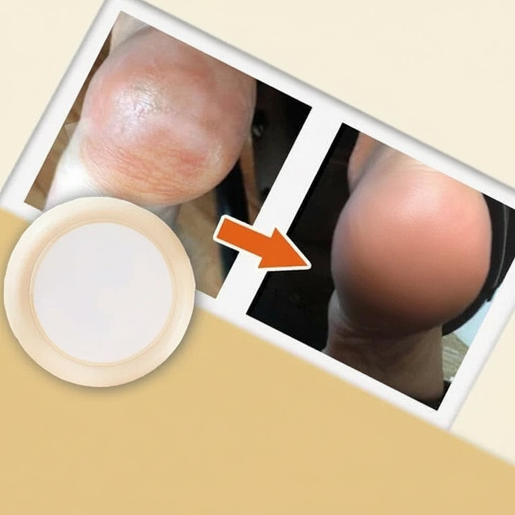Revitalizing Cream for Soft, Smooth Feet and Hands