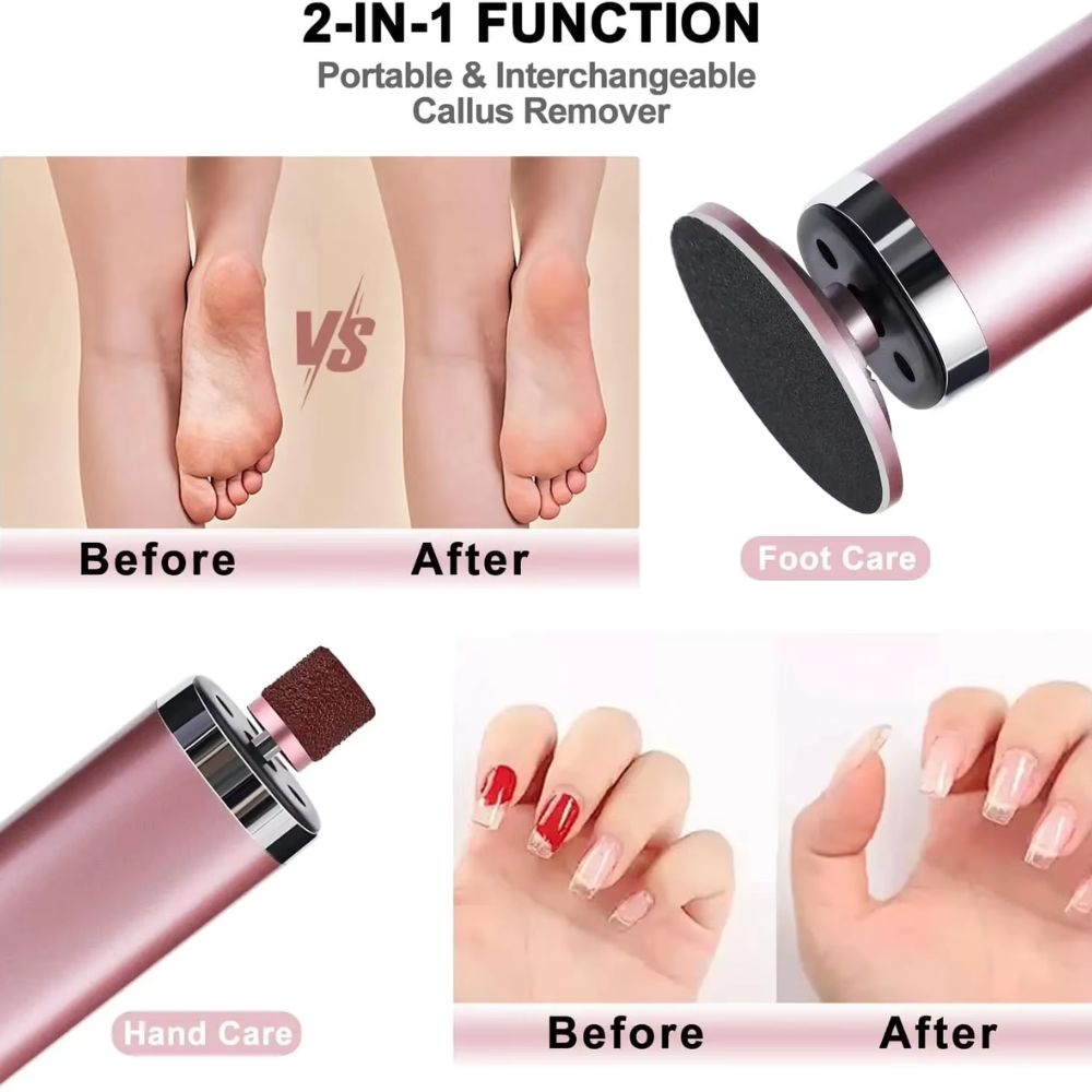 Cordless Rechargeable Pedicure Device - 2-in-1 Callus Remover & Nail File