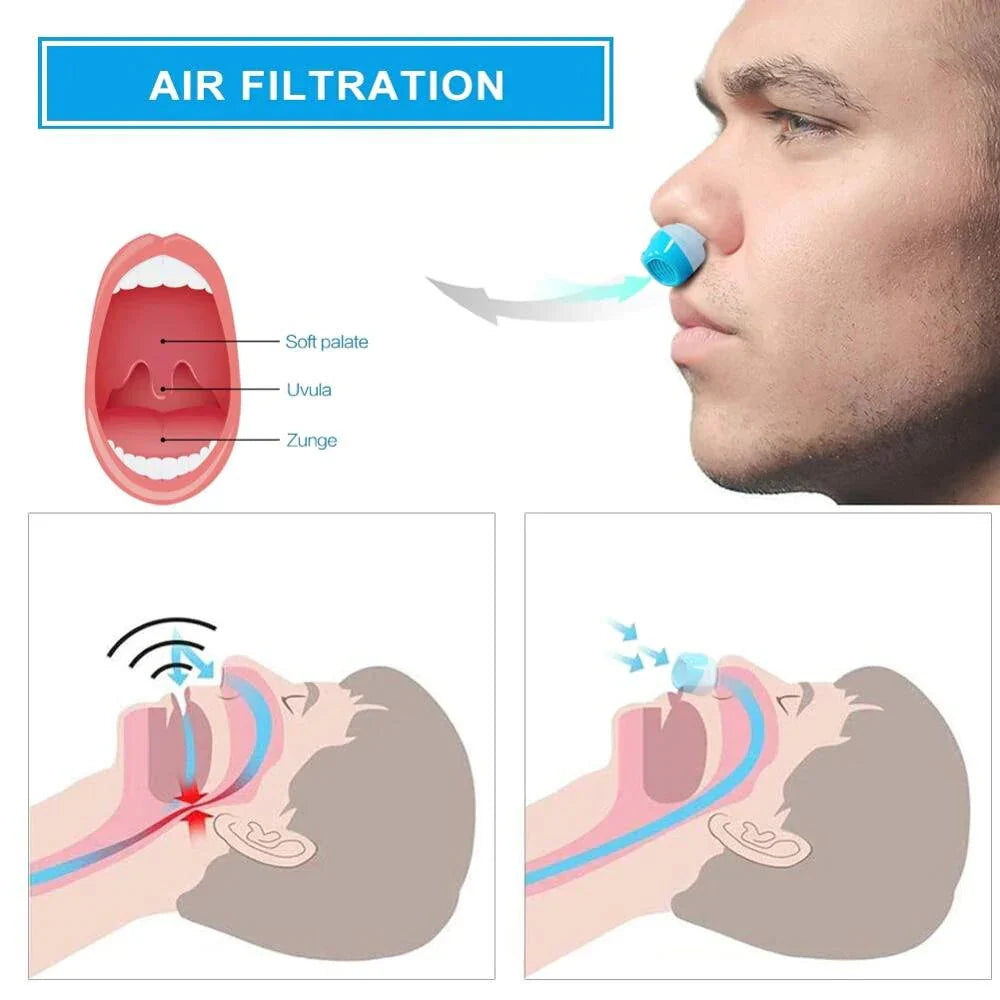 Compact Sleep Solution for Snoring Relief