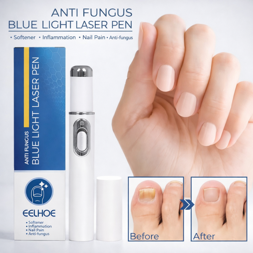 Non-Invasive Blue Light Laser Pen for Nail Fungus Treatment