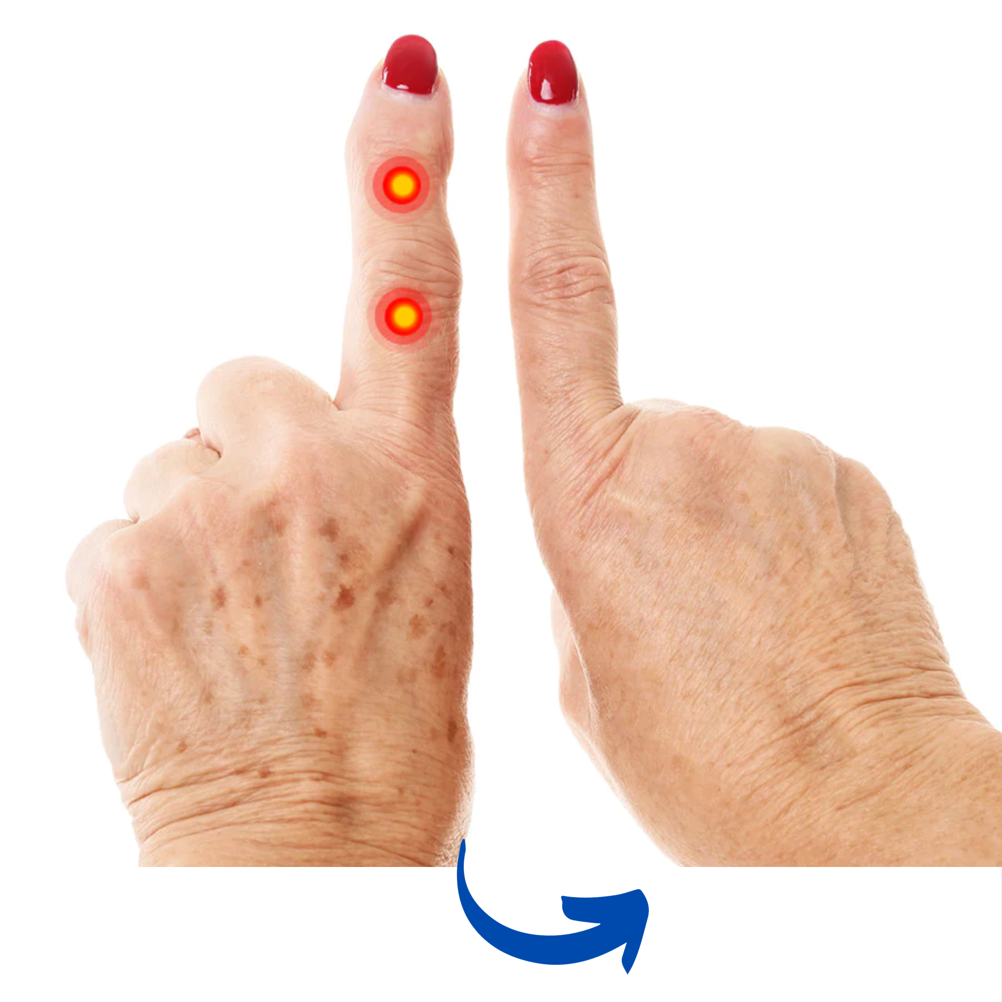 Infrared Therapy Gloves for Arthritis Relief – Ergonomic Design for Hand Function