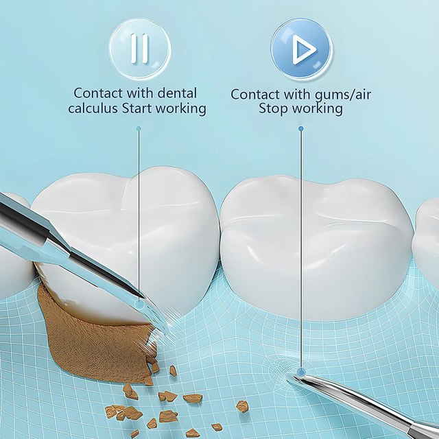 Home Tooth Cleaning Ultrasonic Wand with LED Light and USB Fast Charge