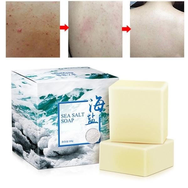 Acne Treatment Soap with Sea Salt
