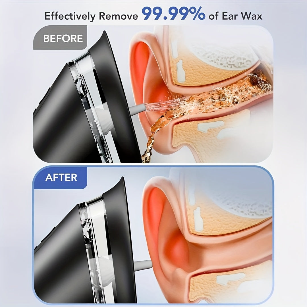 Rechargeable Ear Hygiene Cleaner with Gentle Water Flow