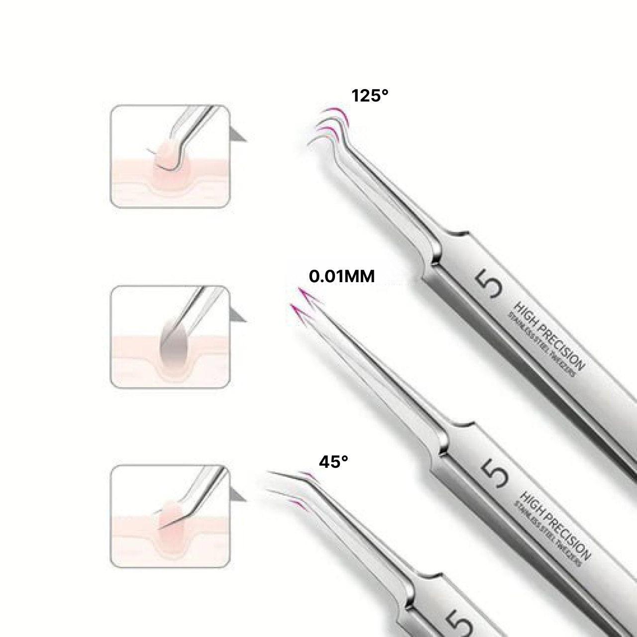 Precision Acne Removal Tool Set - 3-Piece Kit