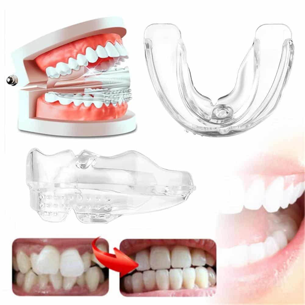Clear Aligners for Teeth Straightening