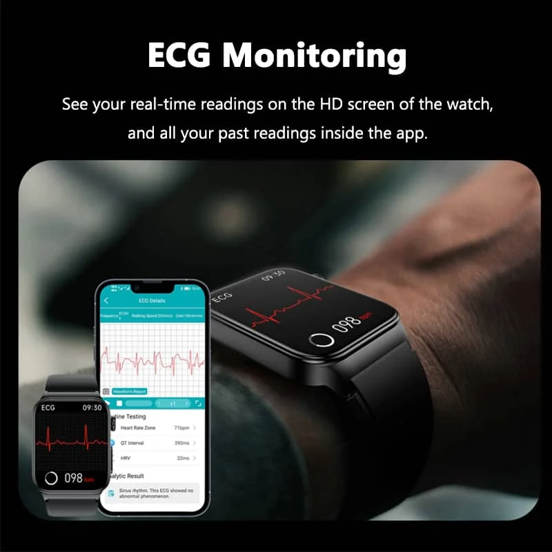 Smartwatch with ECG and Blood Sugar Monitoring | Custom Touch Screen Health Tracker