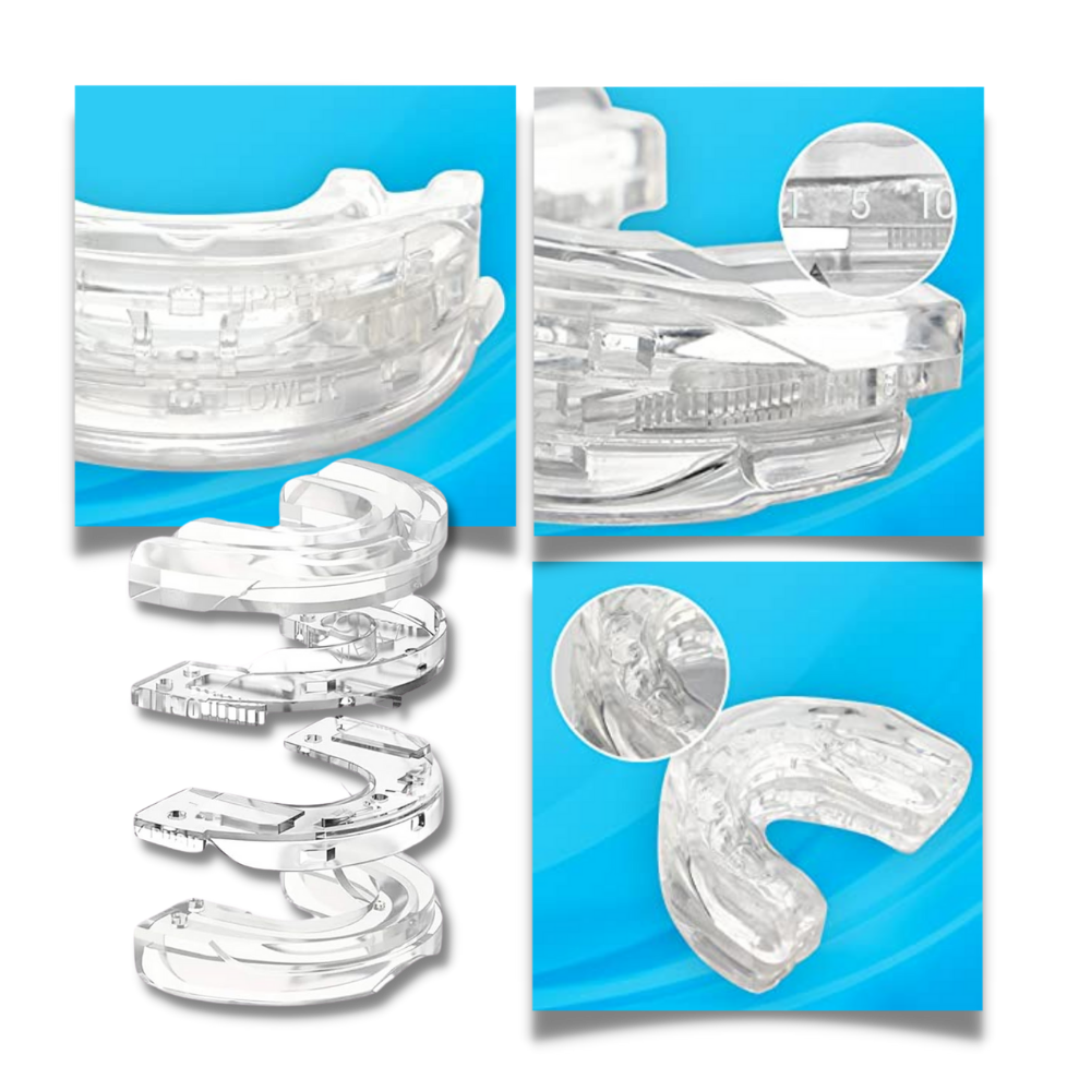 ComfortSmart Snore Relief Device