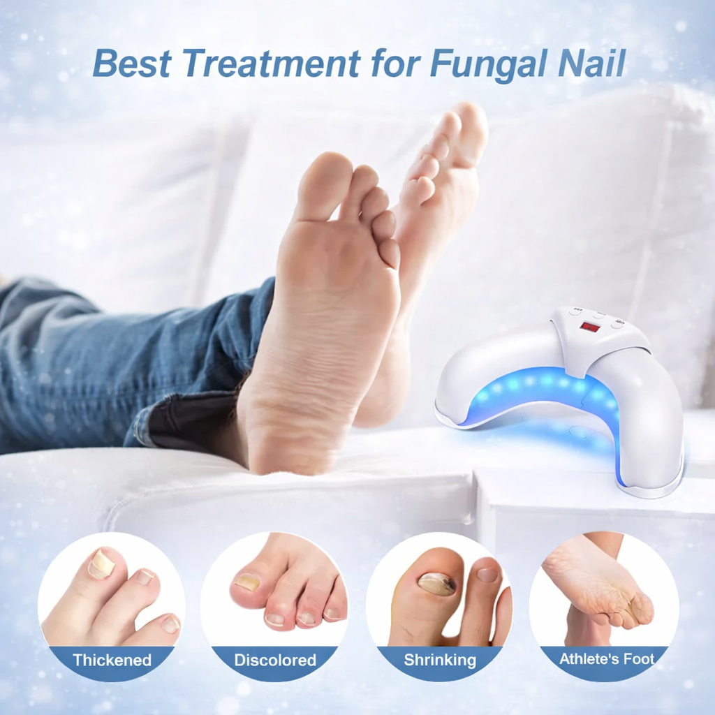 Arc Lamp for Nail Treatment – Blue Light for Fungal and Lime Issues