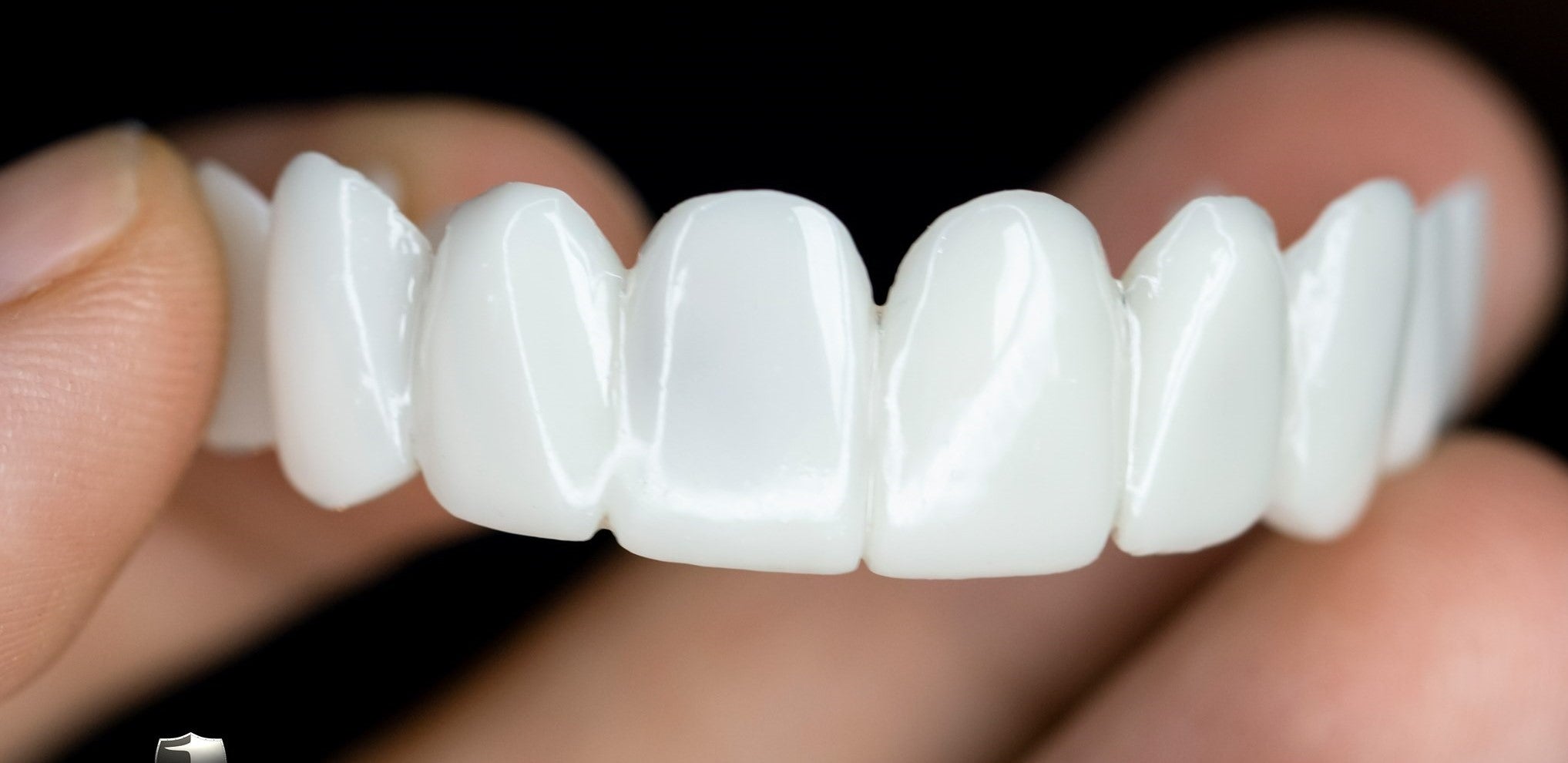 Customizable Dental Prosthesis with Lenses for Natural Appearance and Comfort