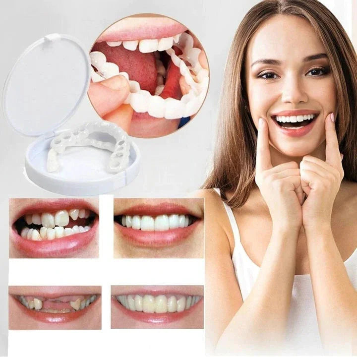 Custom-Fit Removable Veneers for Upper and Lower Teeth – Natural Smile Solution